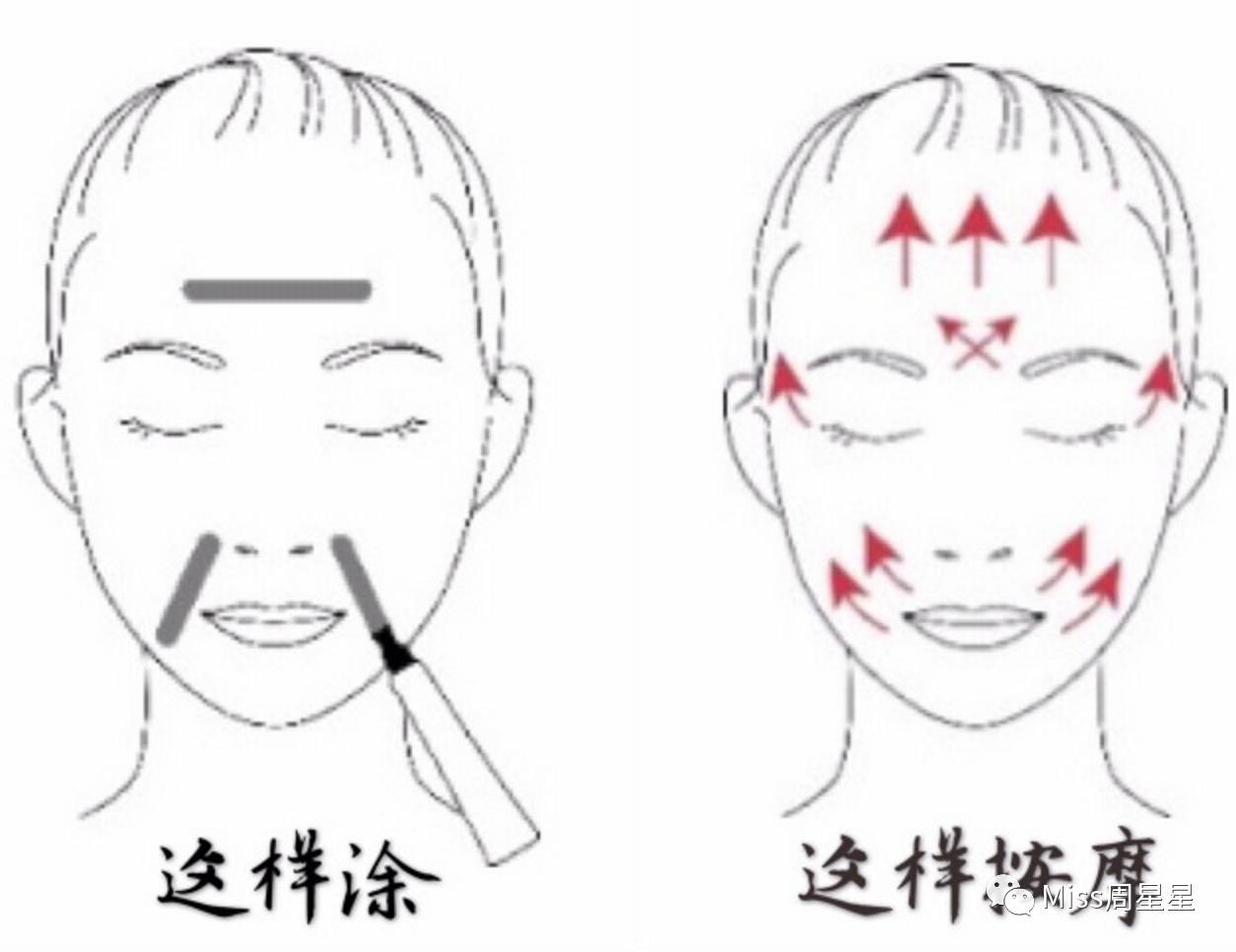 脸部凹陷法令纹用什么美容仪,stop射频美容仪祛法令纹