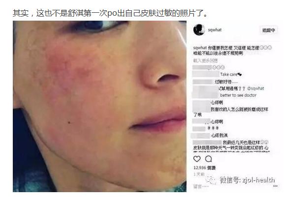 舒淇满脸扎针自拍称治疗过敏！中医治病，厉害的不止针灸还有这些……