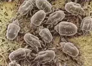 被宝宝咬后皮肤发黄是什么原因,婴儿被虫子咬过之后的皮炎