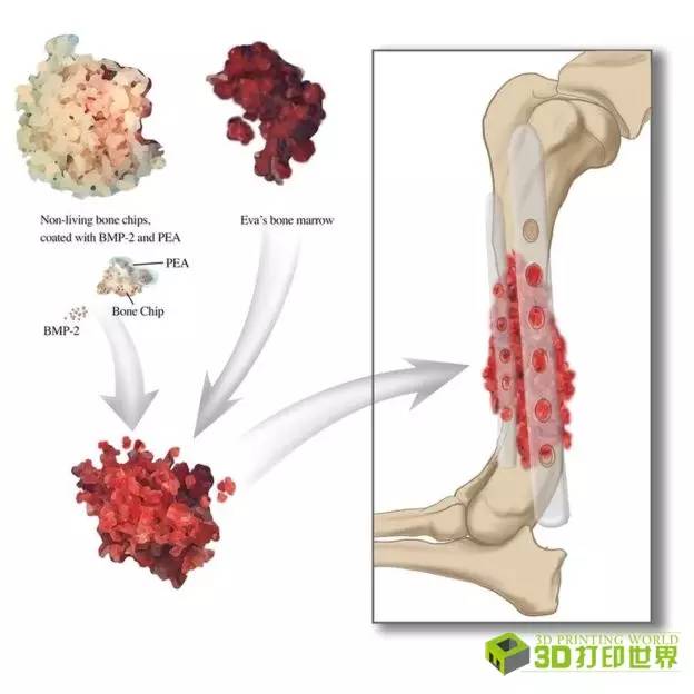冒险为狗子植入3D打印蛋白质合成骨骼，居然成功治愈