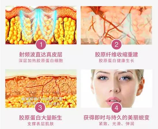 兔妈分享丨价格好爆！以色列Tripollarstop童颜机Luna洁面仪电动硅胶牙刷，吃土都值得入！