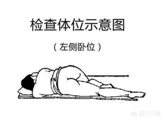 肠镜检查，肛肠检查。。。会不会很尴尬啊