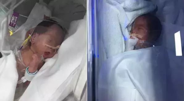 早产双胞胎妈妈的分享,双胞胎妈妈产检心路历程