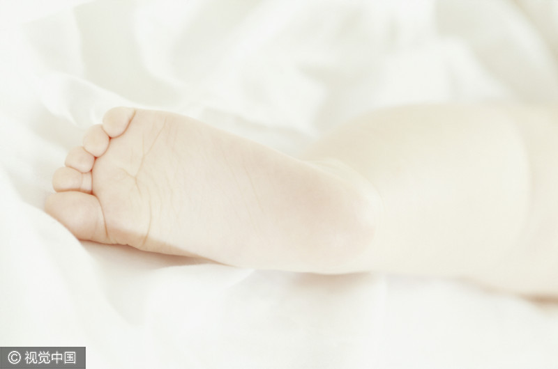 2岁宝宝走路一瘸一拐，医生竟从宝宝脚底取出一根针！