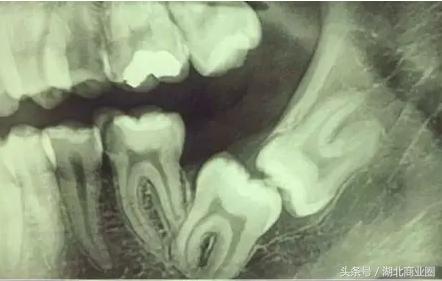 探店:在奢侈级口腔医院里做一把“上帝”