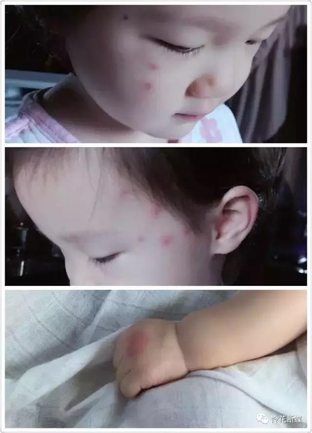 亲测10款驱蚊产品使用报告,驱蚊亲测有效