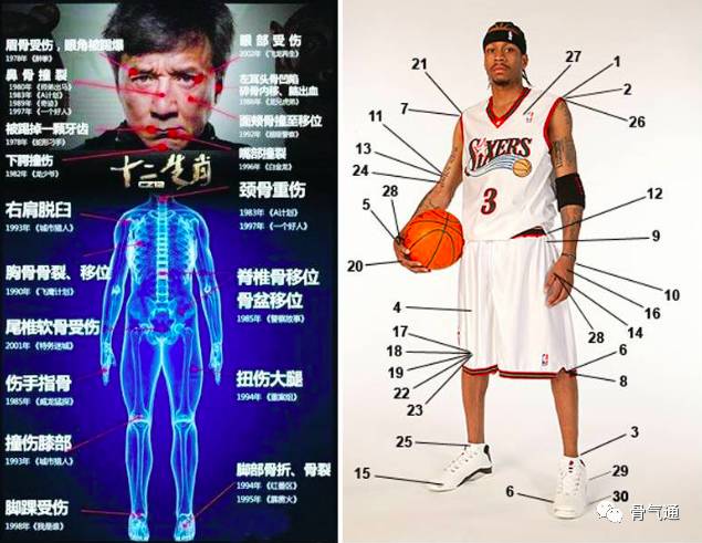 鞋底磨损可以反映身体状况,脊柱告诉你的健康秘密