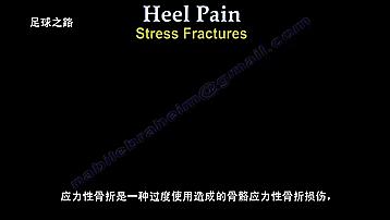 足跟痛最常见病因,足跟痛警惕四种疾病