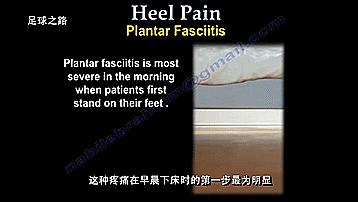 足跟痛最常见病因,足跟痛警惕四种疾病