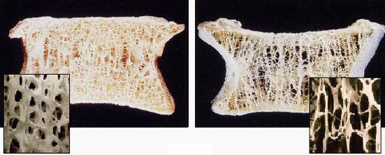 宣武医院肠梗阻,老王摔了一跤断了两根肋骨