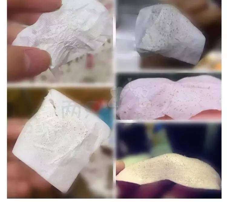 “黑头”这个渣男，彻底和他Say byebye~