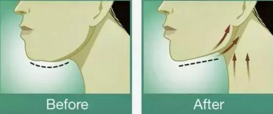 你是圆脸方脸还是瓜子脸,你是虚胖浮肿还是湿气太重