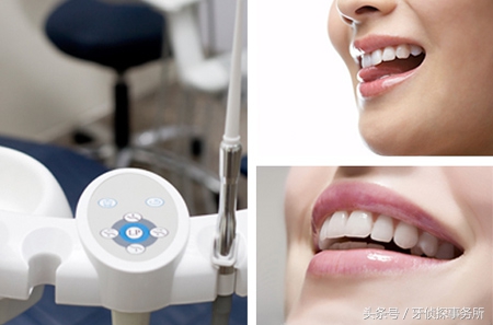 打桩后做的全瓷牙寿命是多久,韩国奥齿泰全瓷牙一般寿命多少年