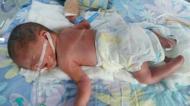 是不是每个孕妈都担心早产,为什么有些孕妈会早产