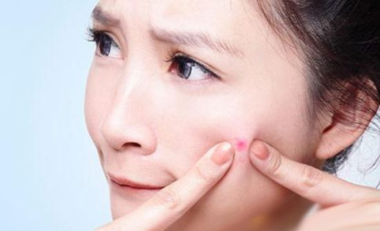 脸部痘痘分布图原因,面部起痘痘位置和原因图片