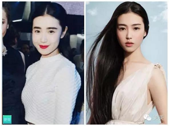 脸部缝美容线好还是普通线好,医院埋线和美容院埋线有什么差别