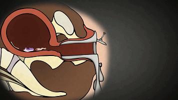 LAN《性、安全、录像带》