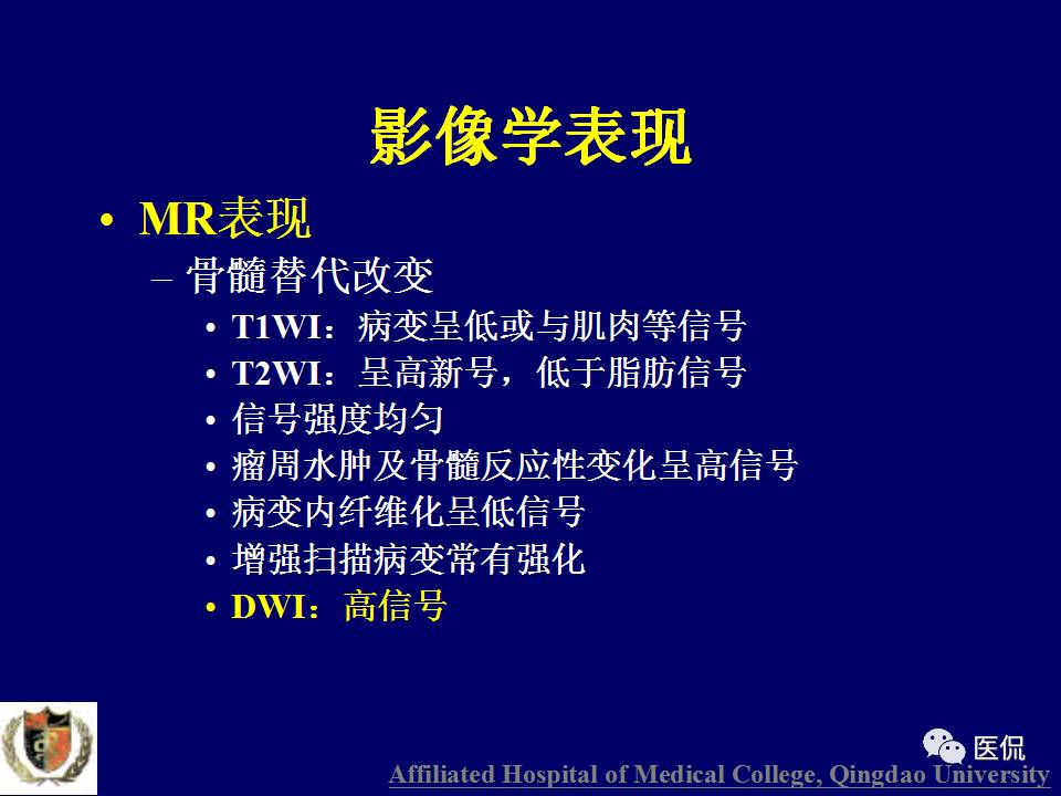 徐文坚老师精讲：原发性骨淋巴瘤影像学诊断医学影像精品PPT