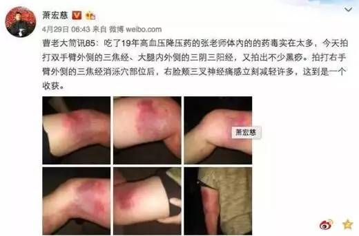 在国内混不下去的“神医”们，远眺海外，目露“金光”……侨胞们要当心了！