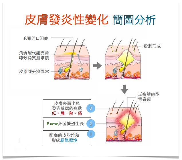 战痘合集完整版,战痘大结局完整版