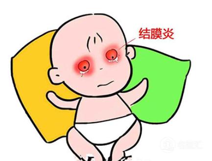 过敏性结膜炎的症状及治疗,得了结膜炎有什么小偏方