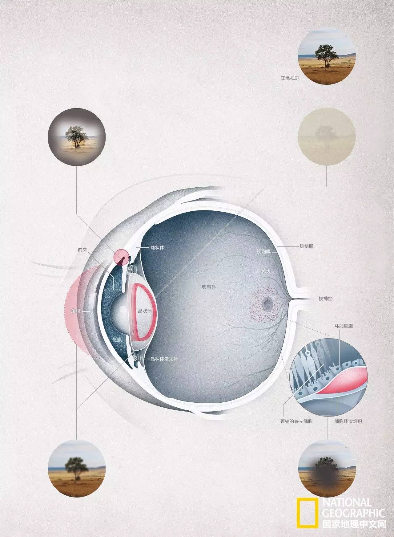 这完全不是科幻片！仿生义眼、干细胞移植、基因疗法……盲症也许马上就要被终结了！