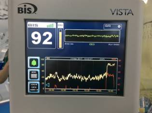 围手术期个案护理比赛优秀案例ppt,术后镇痛的规范化管理ppt