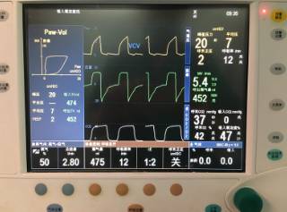 围手术期个案护理比赛优秀案例ppt,术后镇痛的规范化管理ppt