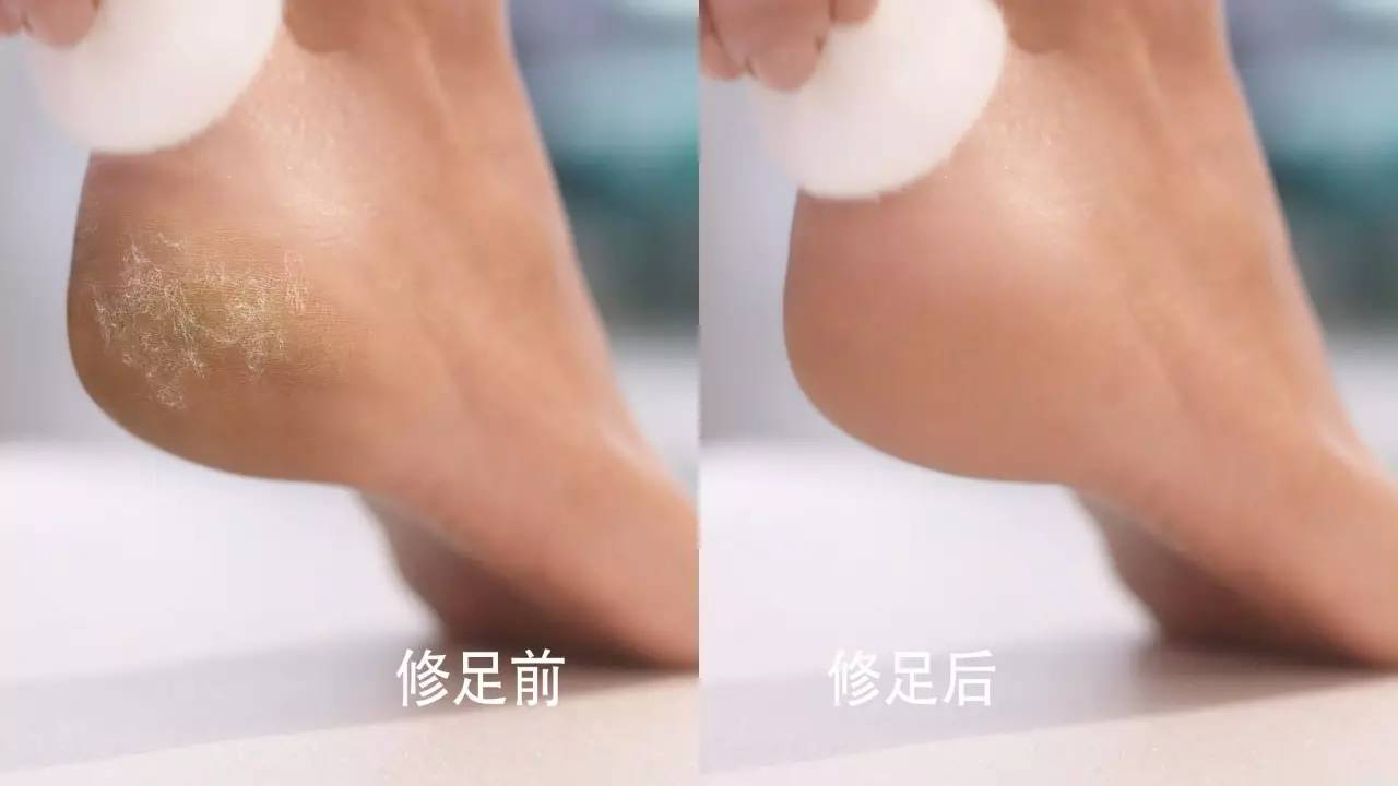 这⑥种神器没入手｜你和你的夏天会过得很「粗糙」……