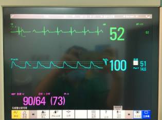 围手术期个案护理比赛优秀案例ppt,术后镇痛的规范化管理ppt