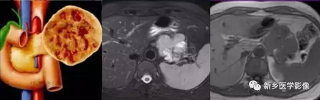 18种疾病包括哪些,18种肿瘤有哪些