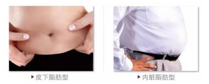 「江西上和糖尿病管理中心」仅知道体重、BMI就够了吗？