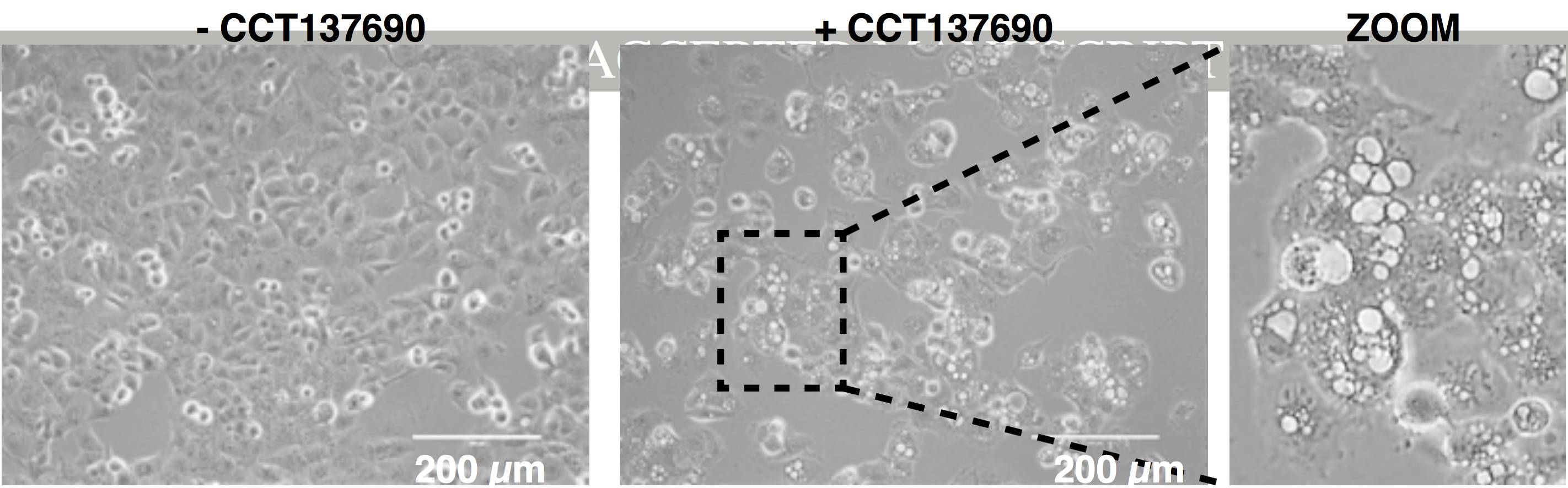 意义非凡！广州医科大学唐道林教授团队发现治疗胰腺癌的新药物和新机制｜科学大发现