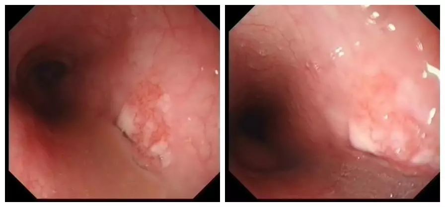 消化内镜都是消化内科医生做的吗,消化内科医生做内镜吗