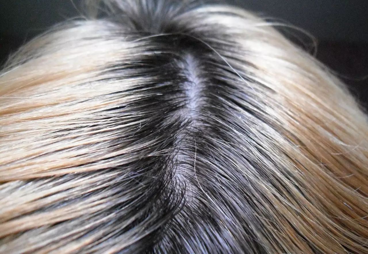 染发完长出黑头发怎么处理,染发后长出黑发怎么扎