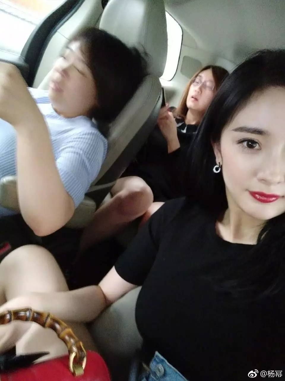 重度下垂的脸怎么恢复,已经下垂的脸还可以拯救吗