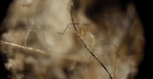 儿童除螨睡眠枕头,儿童螨虫喷雾床上怎么使用