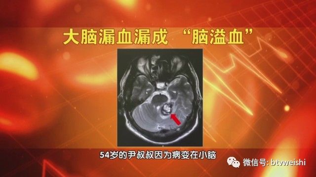 养生堂揭秘大脑的神秘物质,养生堂最新视频