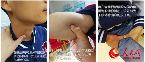 动脉出血最佳抢救时间,动脉出血三十秒