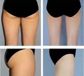 杏林健康养生科普知识,杏林微科普养生方法