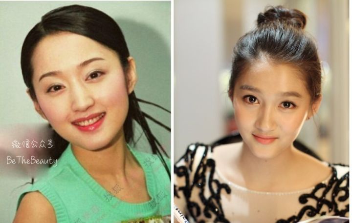 鼻翼宽鼻头大怎么办,塌鼻子鼻翼宽妆容