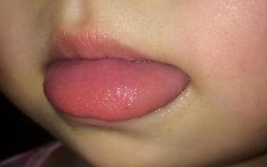 宝宝脾胃不好舌苔图片,婴幼儿脾胃好不好舌苔怎么看