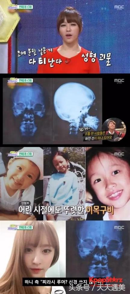 王思聪签的韩国女团EXID不承认整容，还做CT，被网友啪啪打脸！