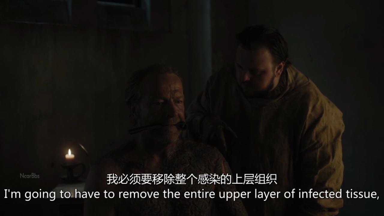 山姆为乔拉爵士刮皮治疗灰麟病你们觉得乔拉会好起来吗?