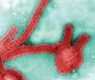 狂犬病毒vs埃博拉病毒,埃博拉病毒和狂犬病毒哪个更厉害