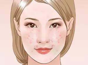 毛孔粗大怎么办教你快速收缩毛孔,毛孔粗大怎么才能有效地收缩毛孔