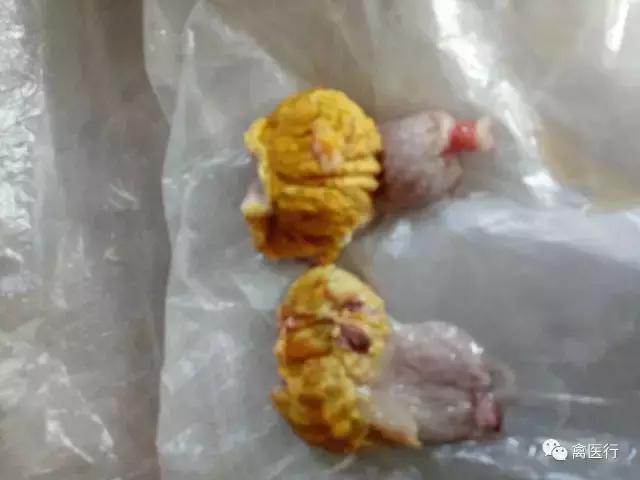 腺肌胃炎，我想买个冒火的加特林哒哒死你