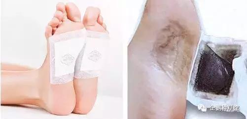 有没有永远不长痘的办法,有没有办法永远不长痘