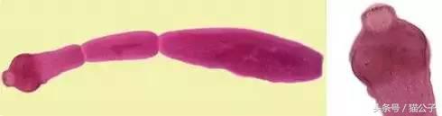 养猫会导致人得脑膜炎吗,养猫会让人得脑瘤吗