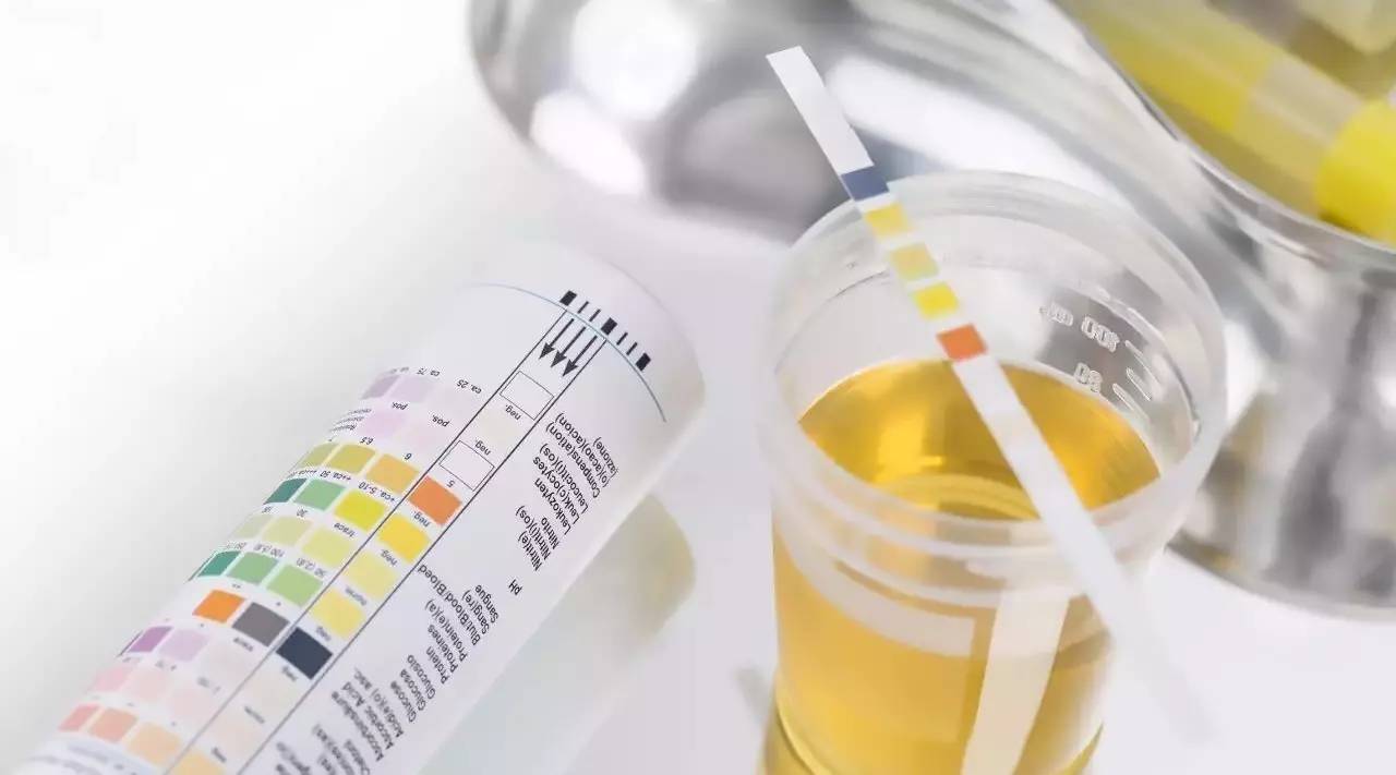 尿检前可以不保留晨尿吗,月经来之前尿检会尿隐血吗